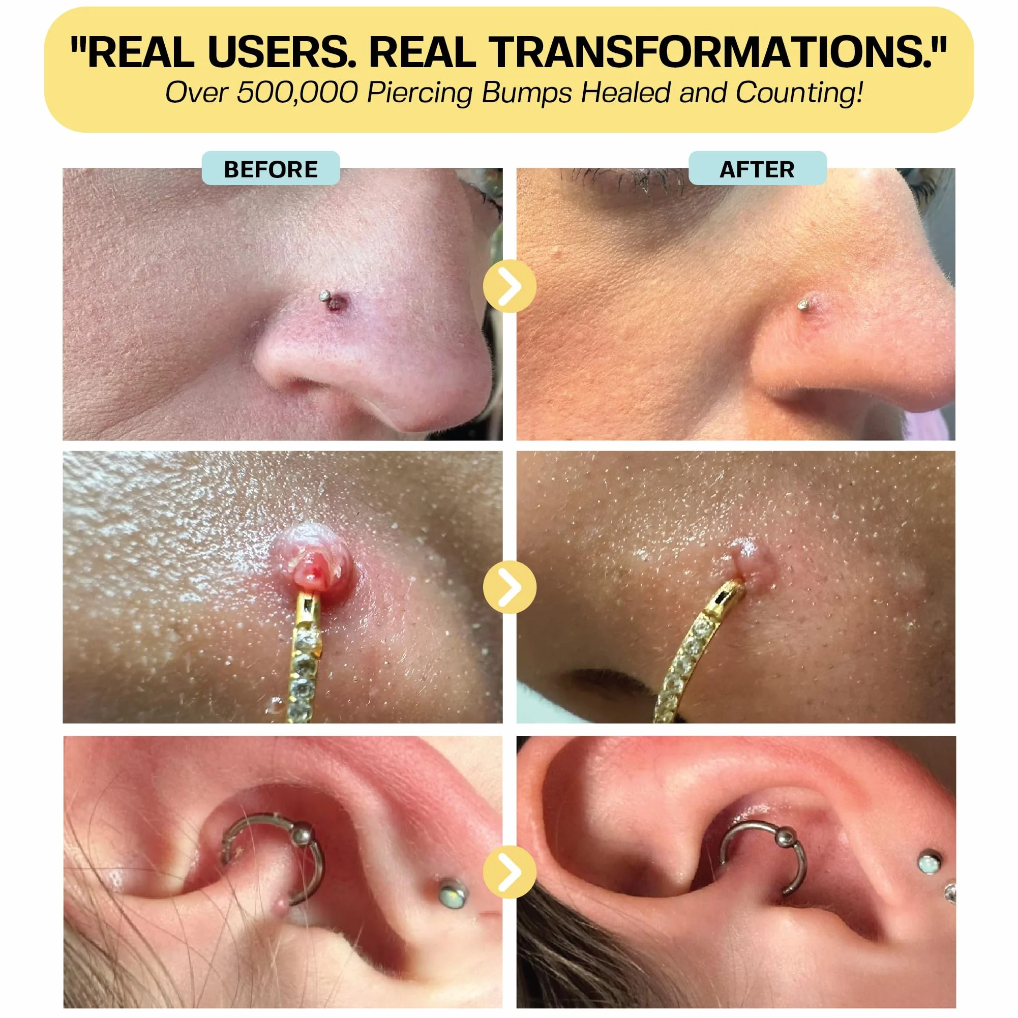 base labs piercing aftercare drops