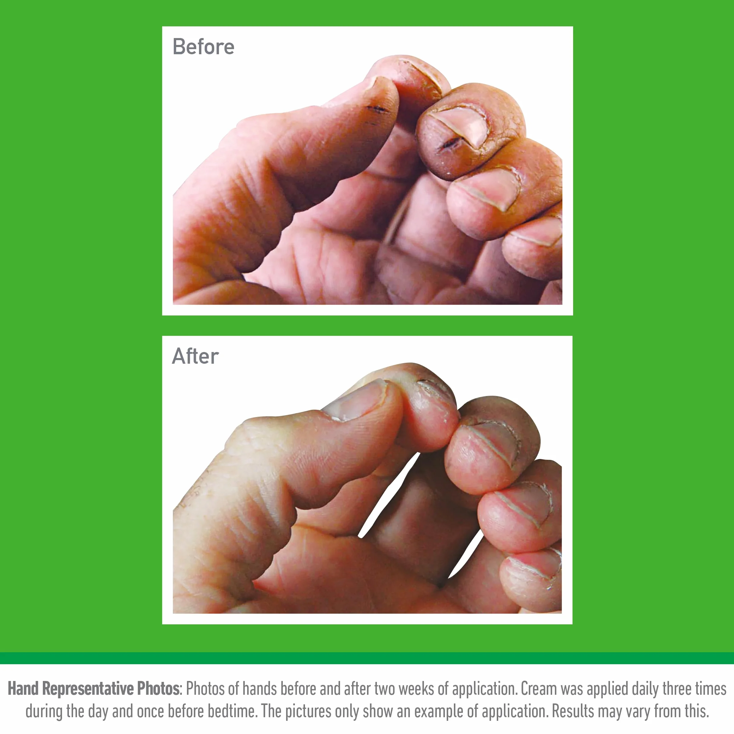 O'Keeffe's Working Hands - Zestaw 2 pojemników na krem do rąk do ekstremalnie suchych i pękniętych rąk, natychmiast zwiększa zawartość wilgoci, tworzy warstwę ochronną i zapobiega
