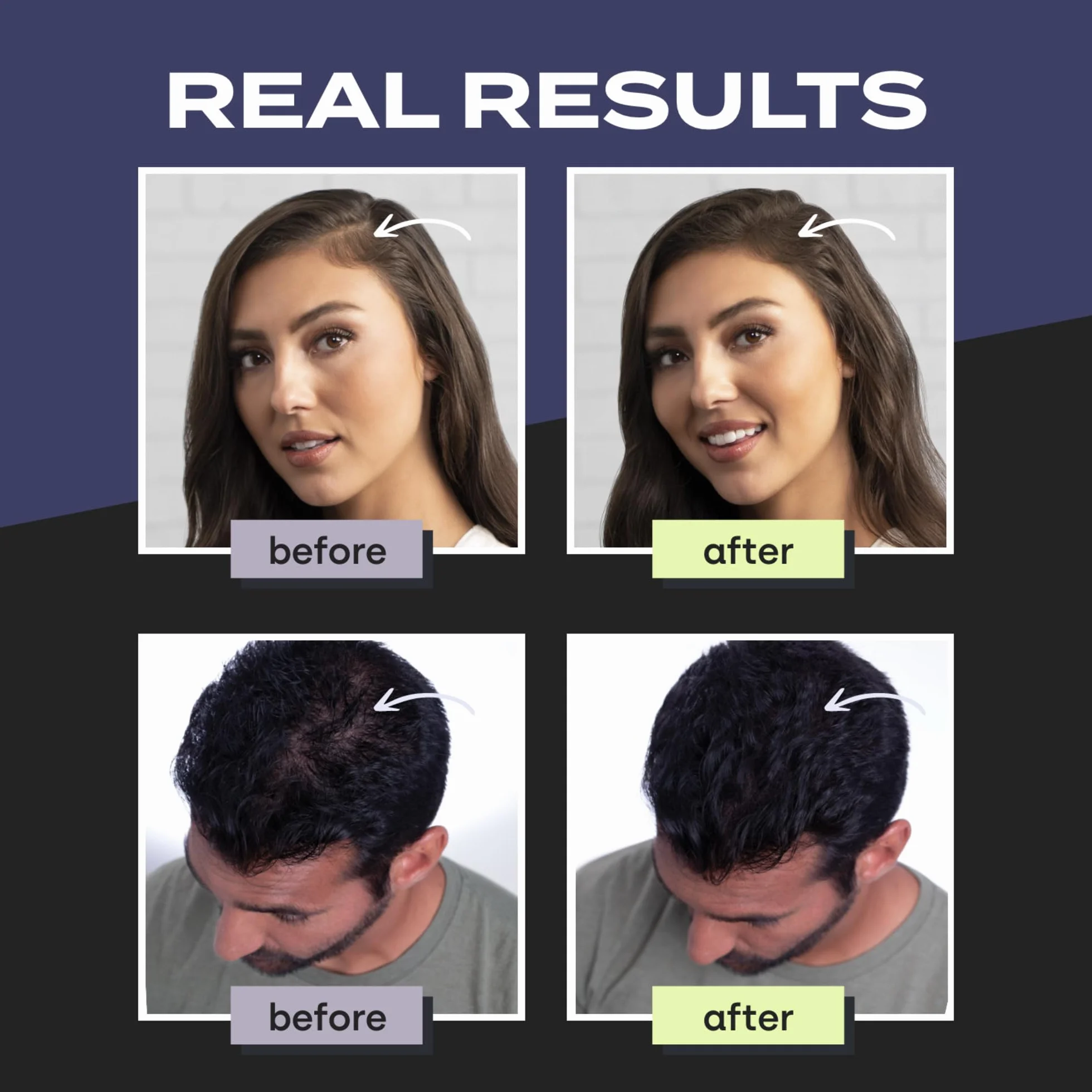 TOPPIK Hair Building Fibers, 3 g