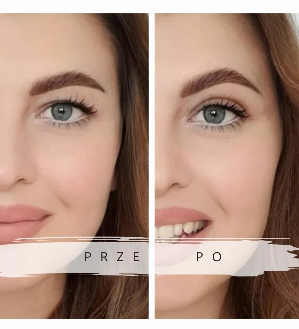 Wundertape naklejki korygujące opadające powieki, 240 sztuk, rozmiar L, do podniesienia powiek bez zabiegu operacyjnego (wodoodporne, trzymają się 24 godziny)