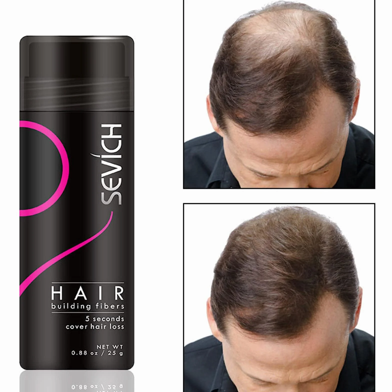 Włókna Włosów - Ukryj łysienie Natychmiast - 100% Naturalna Bawełna Proszek z Mikrofibry dla Mężczyzn i Kobiet (Średni Blond 25g)