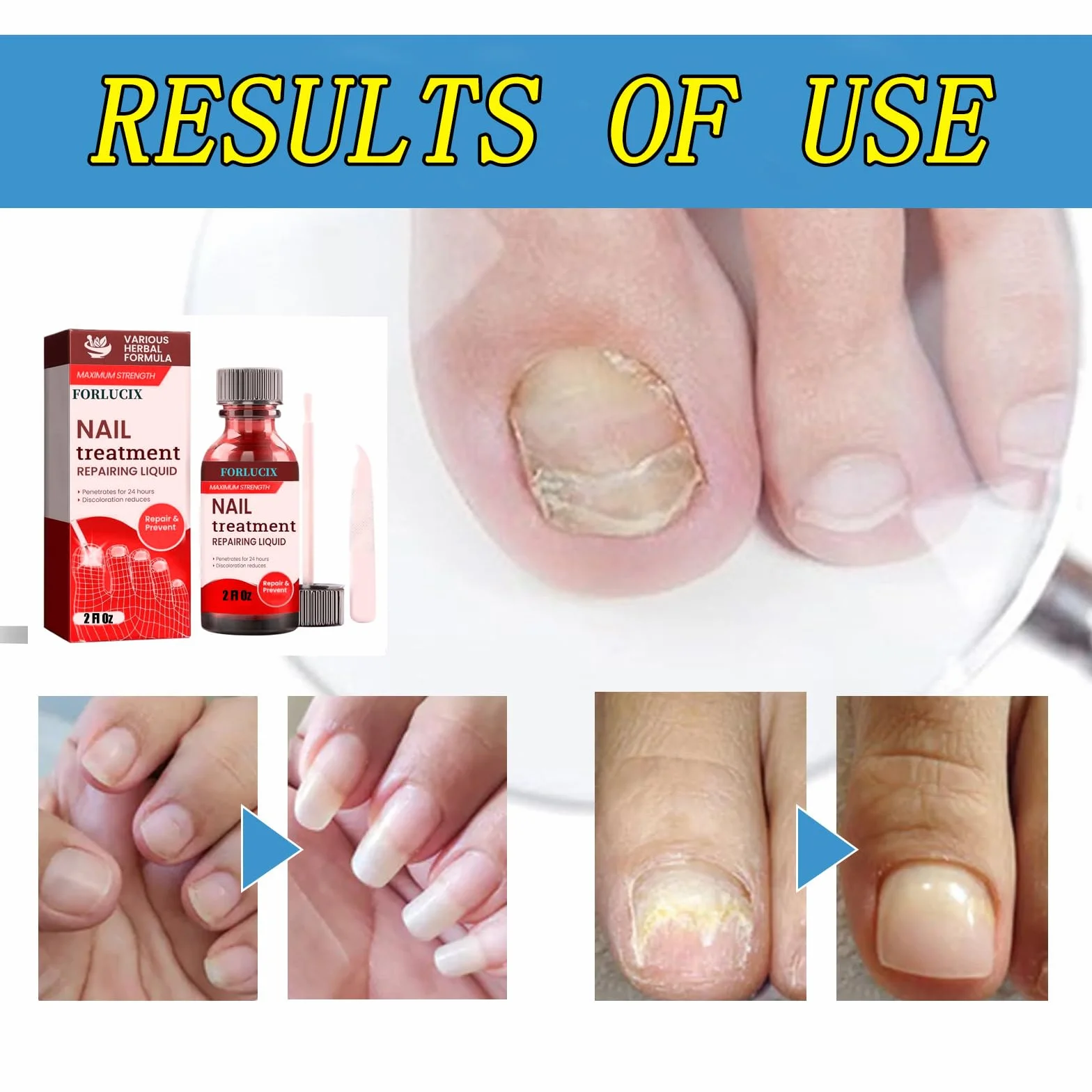 Extra Strength,2 Fl Oz(Pack of 1),Red
