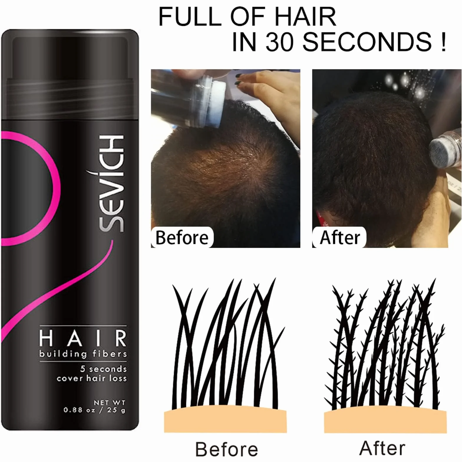 Włókna Włosów - Ukryj łysienie Natychmiast - 100% Naturalna Bawełna Proszek z Mikrofibry dla Mężczyzn i Kobiet (Średni Blond 25g)