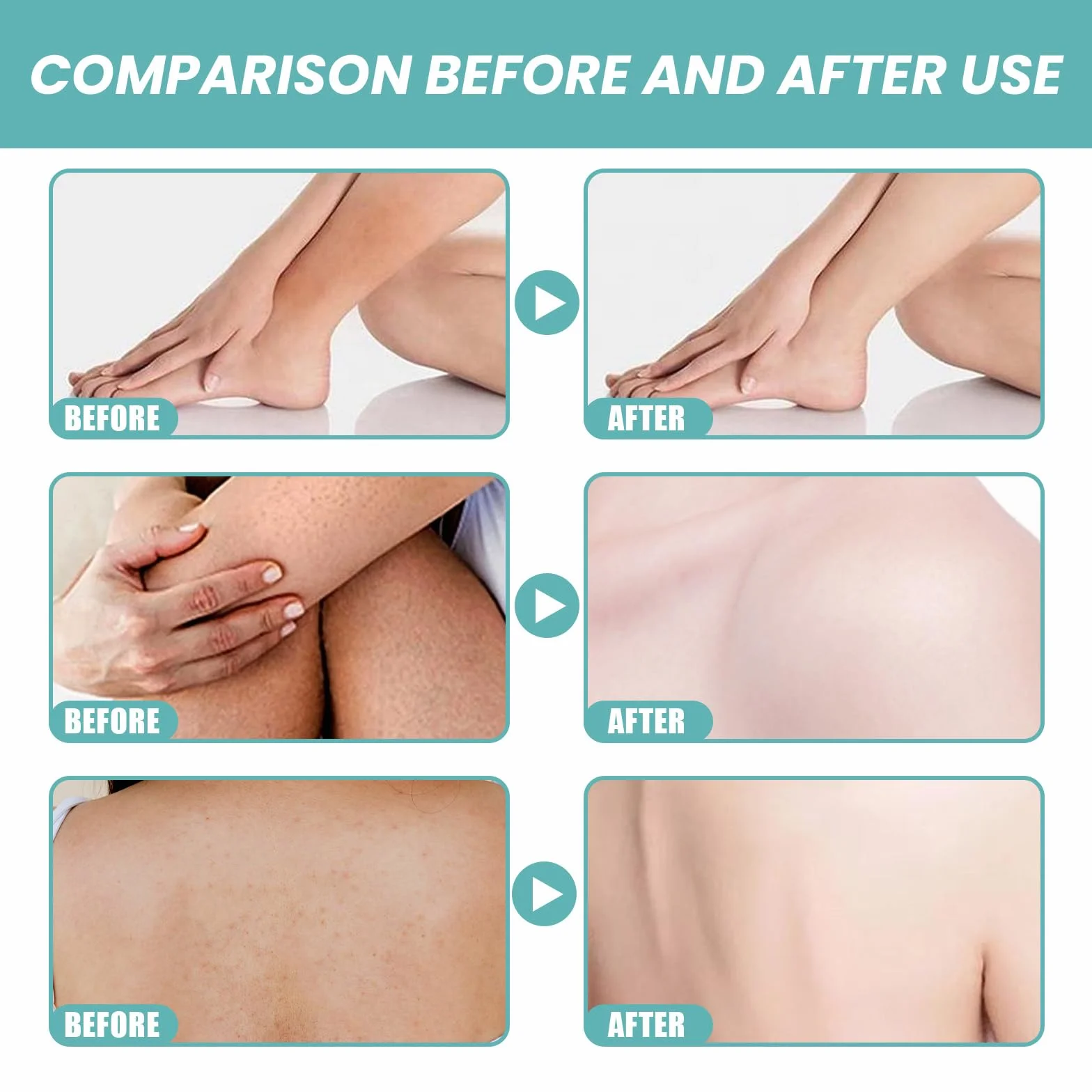 Acidified Original Skin Bath Oil So Soft Original Skin Bath Oil So Soft, oryginalny olejek do kąpieli, miękki, miękki, oryginalny olejek do kąpieli, wygładza i zmiękcza suchą lub szorstką skórę